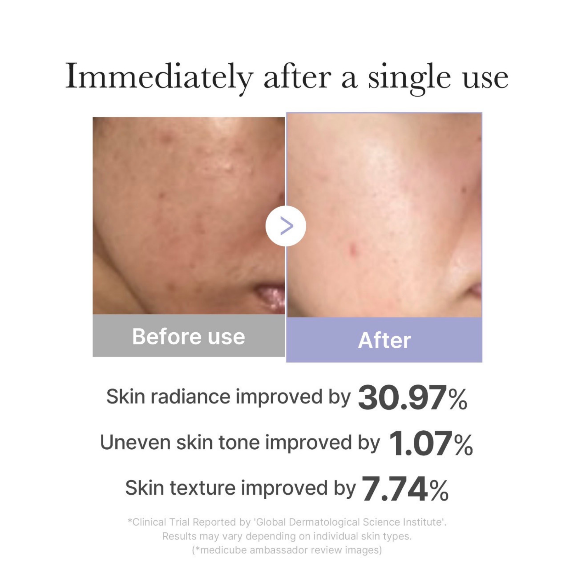 Dispositivo Facial Reafirmante y Luminosidad (Medicube)